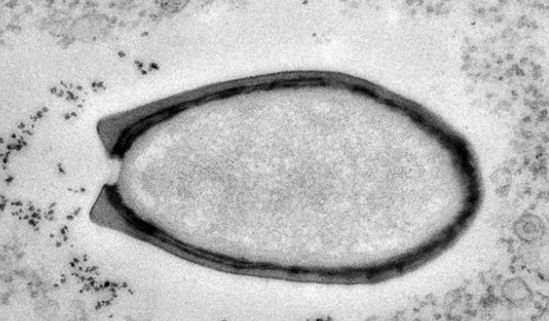 为了什么？48500年前冰封病毒被法国科学家复活：人类非宿主、不会被感染 -图3
